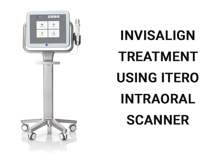 What Are iTero Intraoral Scanners?