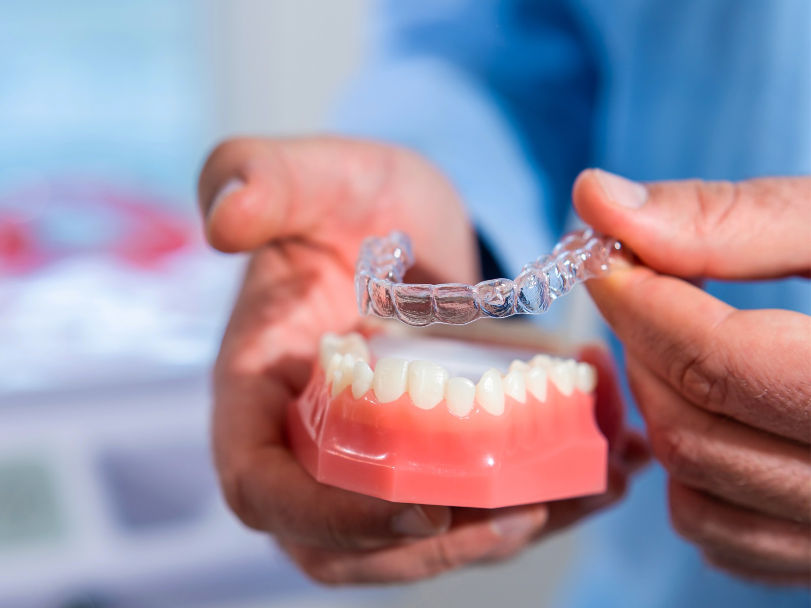 The Top 5 Reasons To Get Clear Aligners