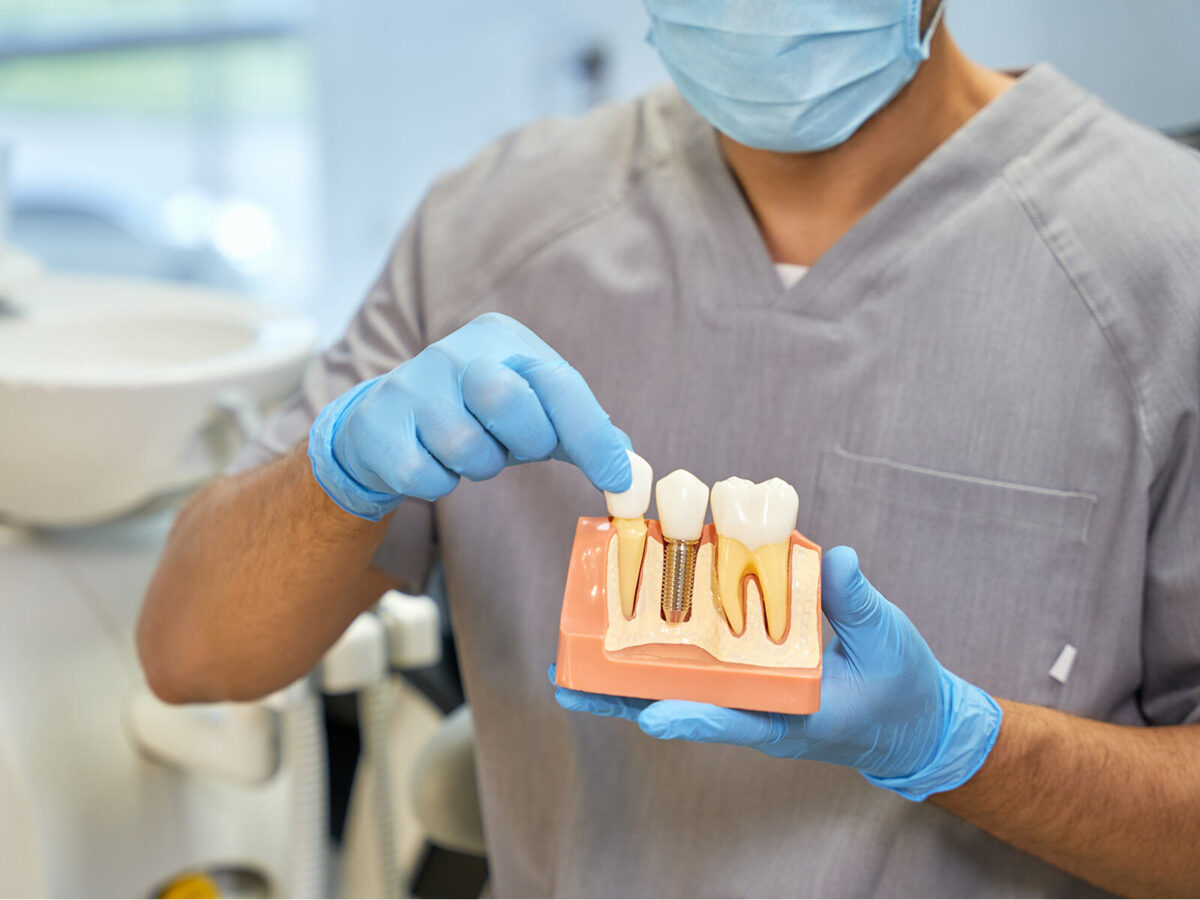 How Many Teeth Can Be Replaced With Dental Implants