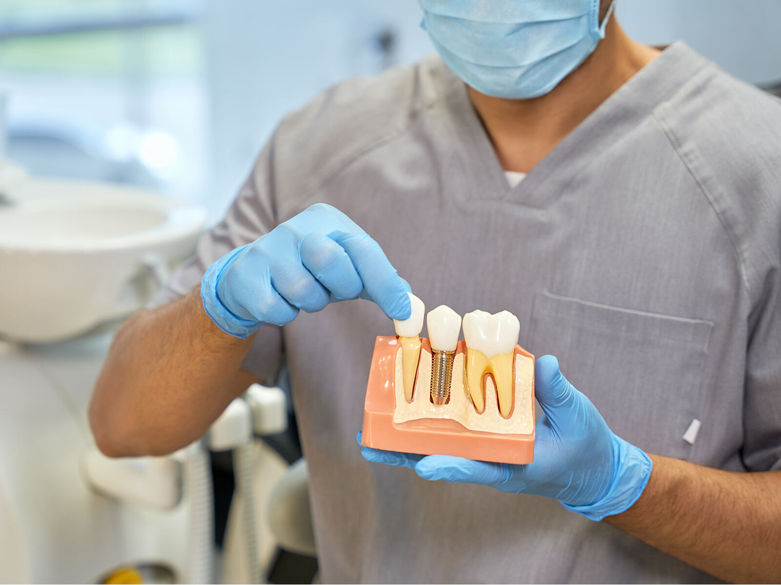How Many Teeth Can Be Replaced With Dental Implants?