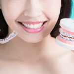 Traditional Braces Vs. Clear Aligners