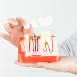 The Role of Implant Dentistry In Enhancing Quality of Life