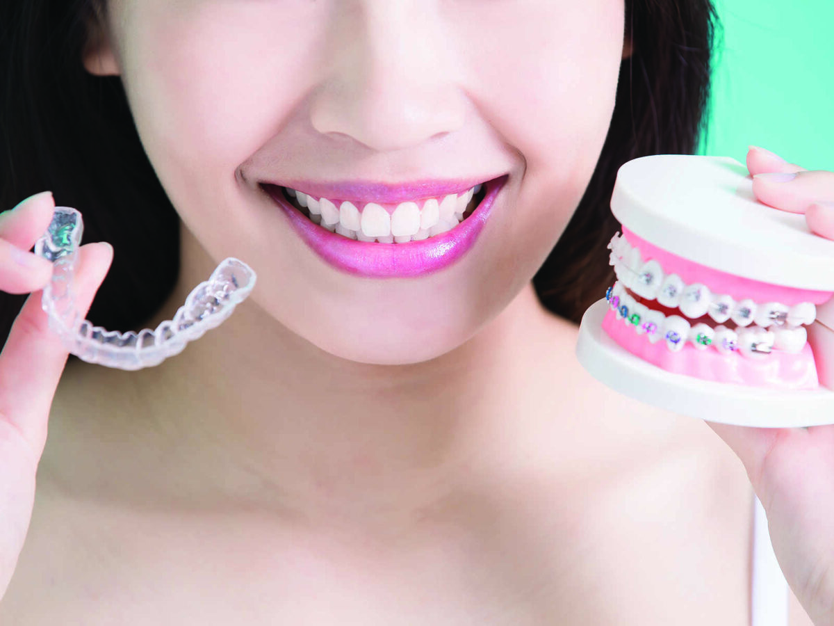 6 Reasons Why Invisalign Is Better Than Braces