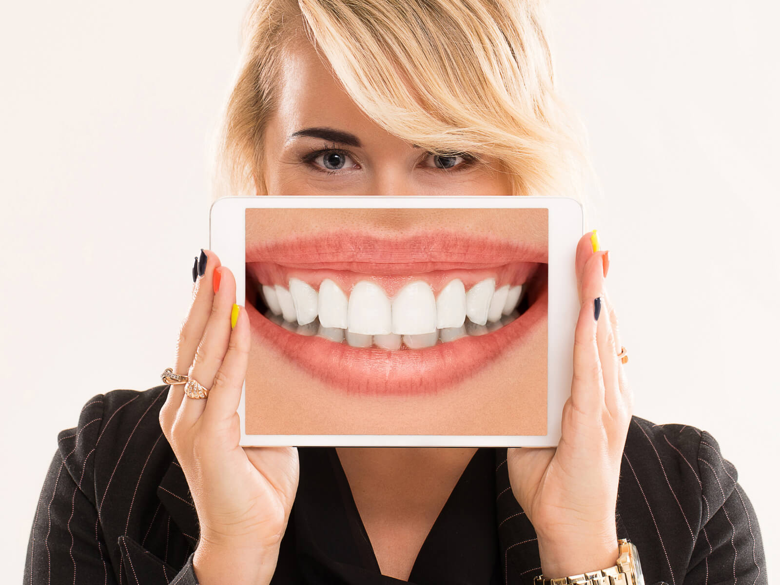 7 Questions To Ask Before Getting Teeth Whitening