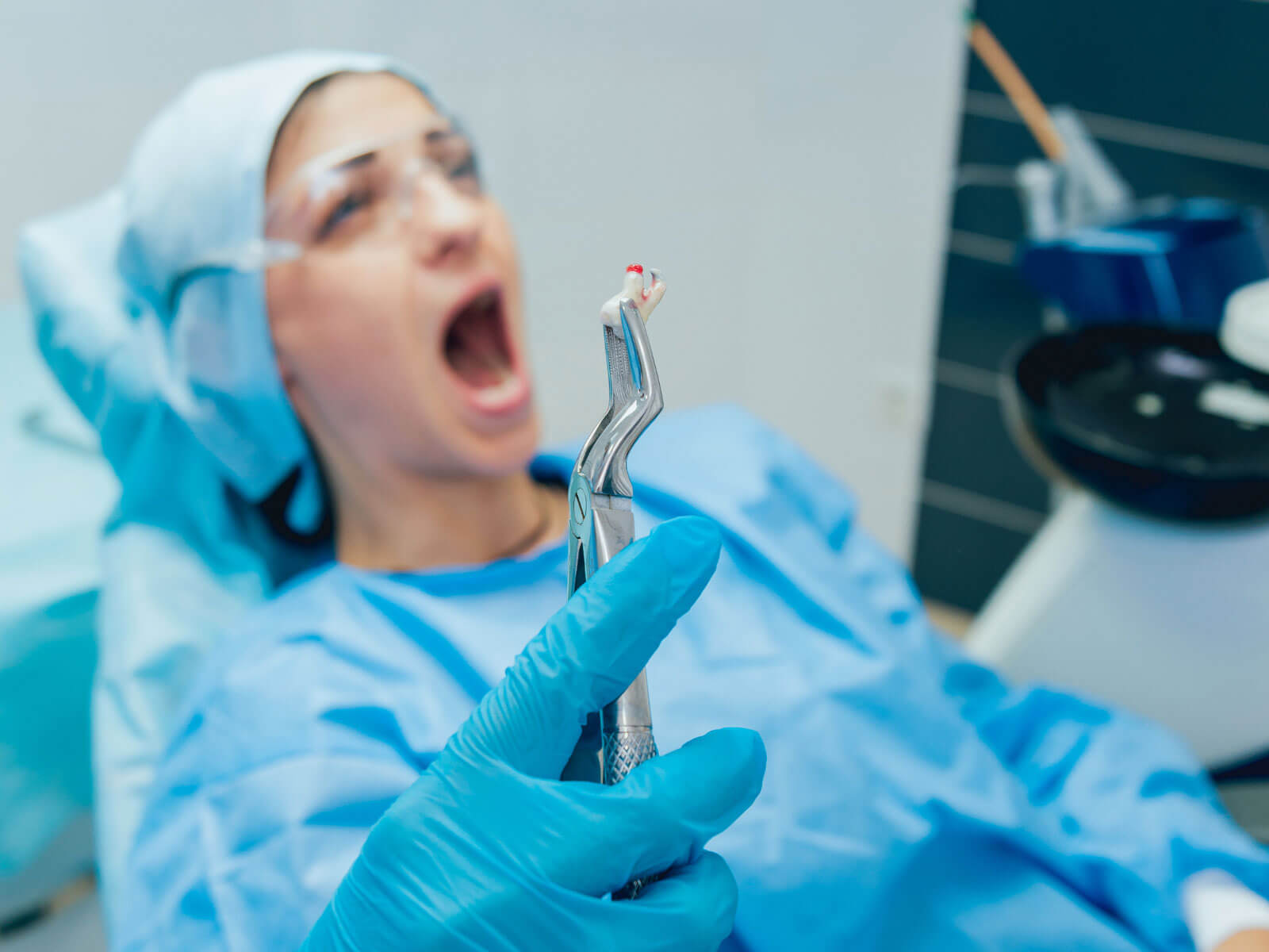 When Is It Safe to Use a Straw After Wisdom Tooth Extraction?